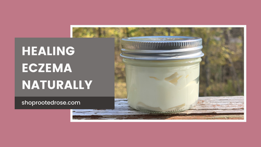 Healing eczema naturally